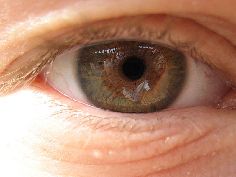száraz makula degeneráció gyógyszer a látás javítása után
